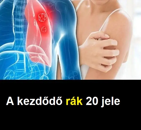 A kezdodo rak 20 jele 600x381