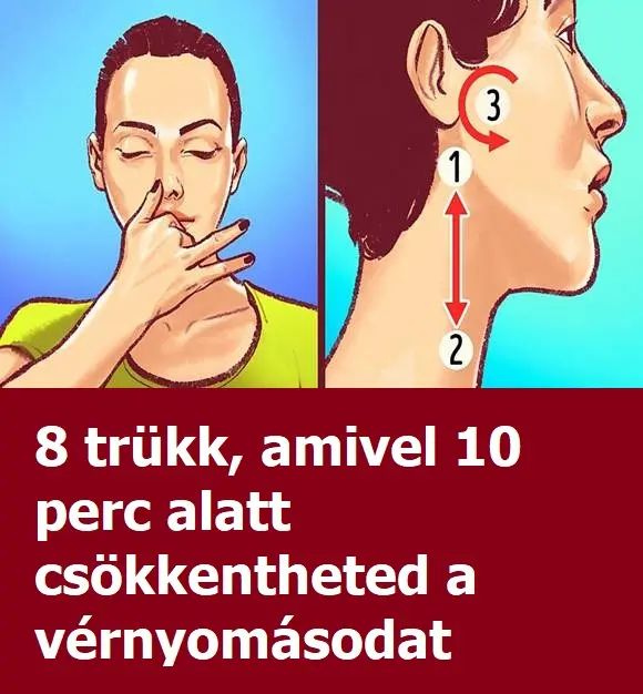 vernyomas