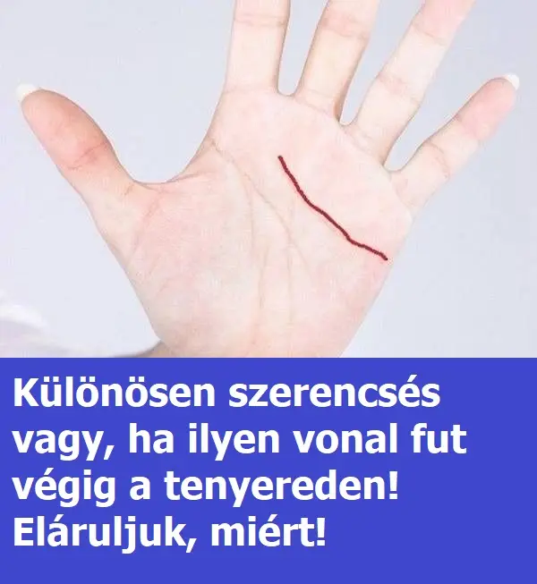 eletvonal6925063 n